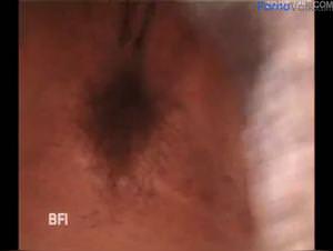 Dog Fuck Girl on Cottage