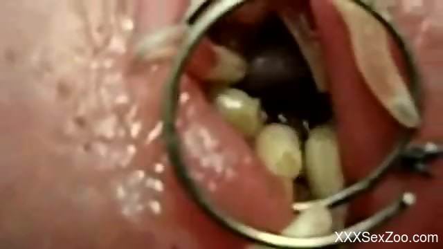 Dude's urethra is now filled with lots of maggots